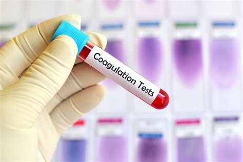 blood clotting tests